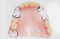 クラスプ・バー付き保険のアクリルデンチャー